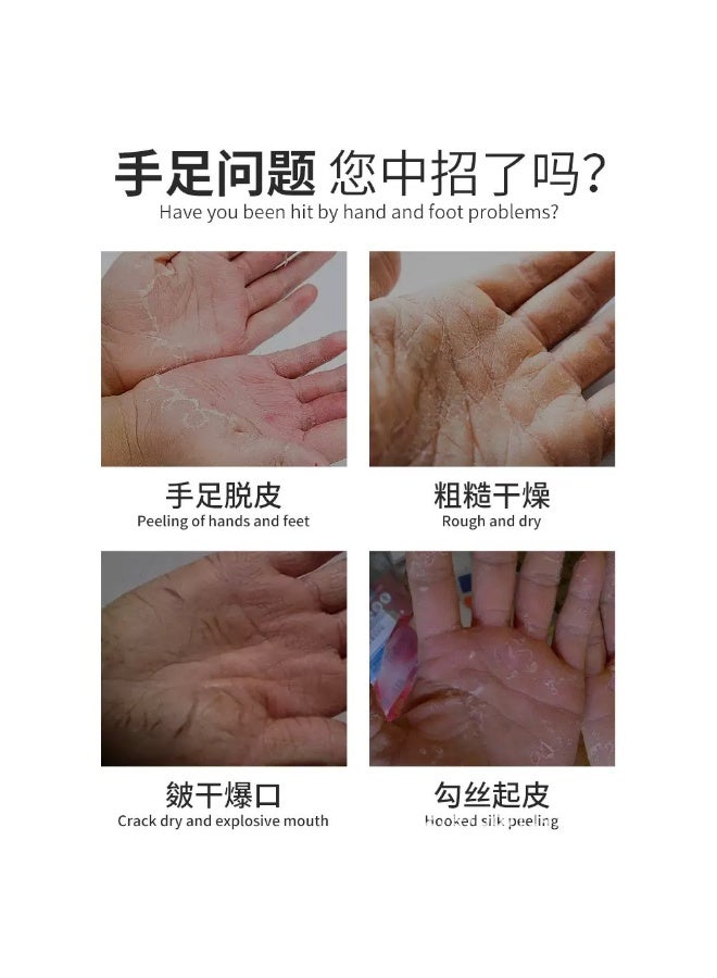 APGAR Hand and Foot Peeling Antibacterial Repair Cream: Deeply moisturizes, powerfully inhibits bacteria, say goodbye to dry, cracked, and peeling skin. - Image 3